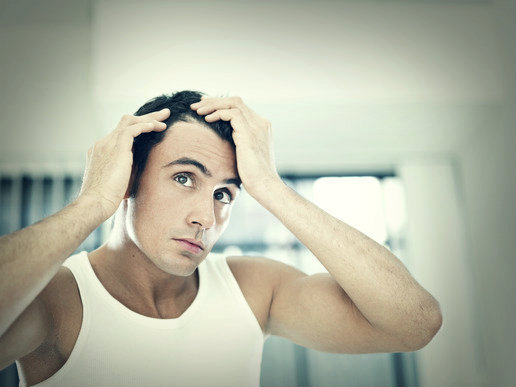 Hairloss - stop a receding hairline